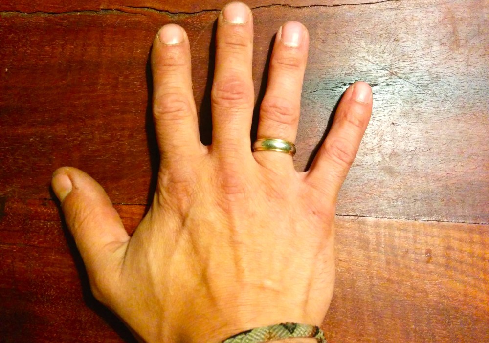 Wedding ring worn on right hand.